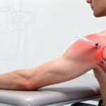 Peut-on travailler après une infiltration de l'épaule ?